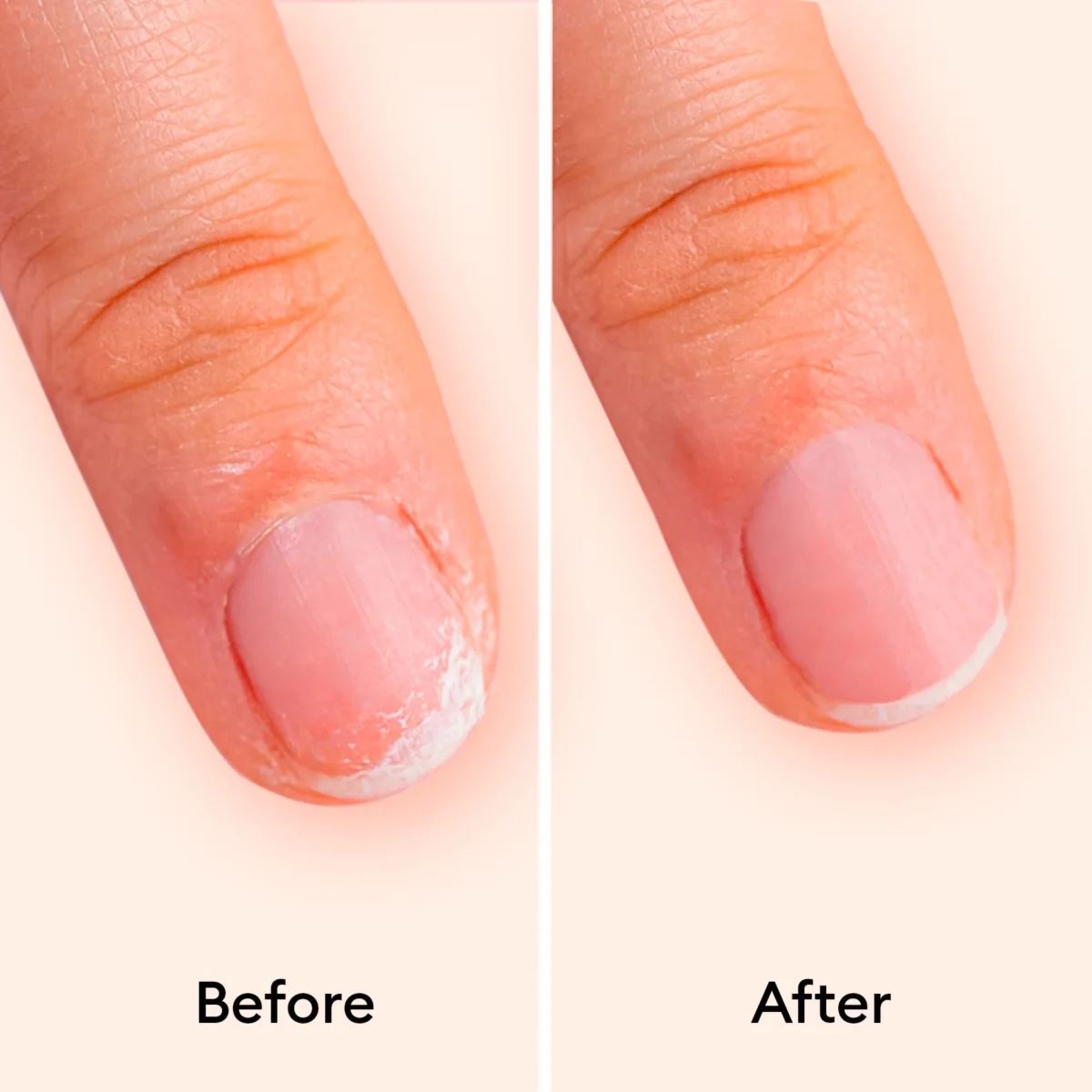 Manucurist nagų stiprinimo serumas "Keratine Booster" 15ml - Image 3