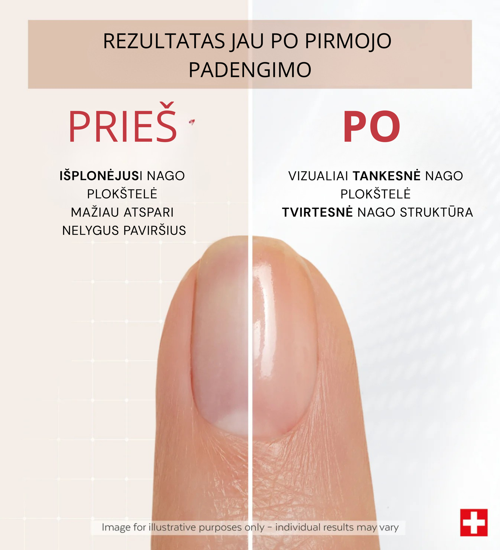 Silpnų nagų korekcija su PODERM Keratin Redensifying – prieš ir po
