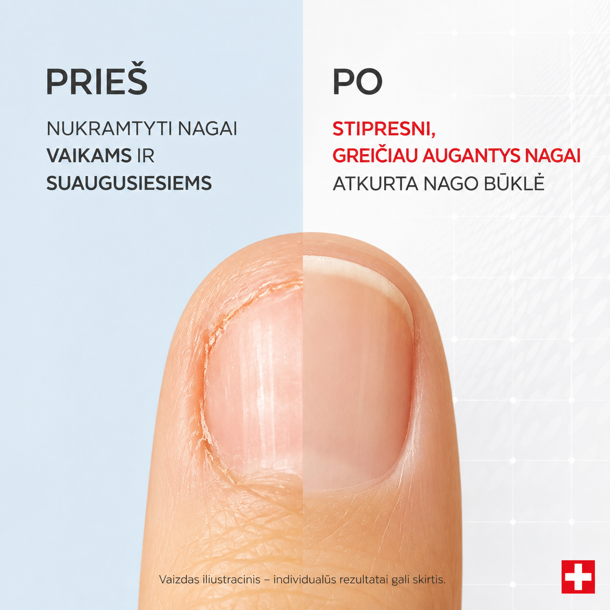 poderm-serumas-nukramtytiems-nagams-pries-po